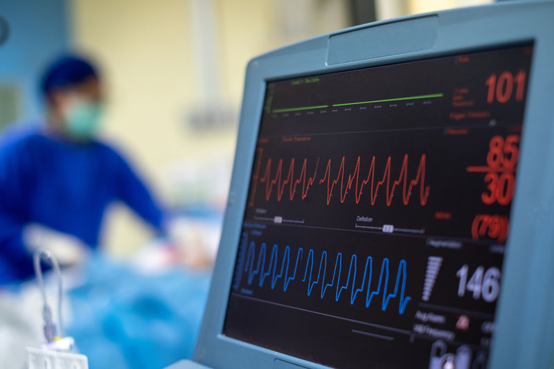 Medizinische equipment- Shielding: EKG recording in the operating room